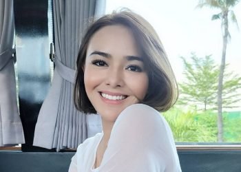 Pengakuan Amanda Manopo Idap Epilepsi