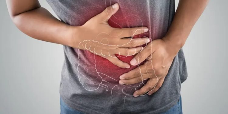 penyebab-sering-kentut-cara-mengatasi