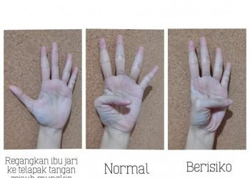 Tes Risiko Penyakit Jantung