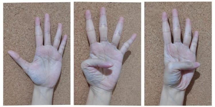 Tes Risiko Penyakit Jantung