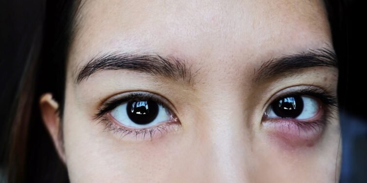 batas-waktu-mata-bintitan-sembuh